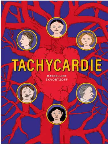 Tachycardie 